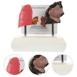 MUCKLILY Lung Comparison Model Medical Teaching Tool vs Normal Lungs Display Student Study Educational Purposes