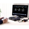 Tendak Composite S-Video AV RCA CVBS to HDMI Adapter N64