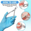 Poshome Bracket Remover for Braces Removal Tool Orthodontic Bracket Removing