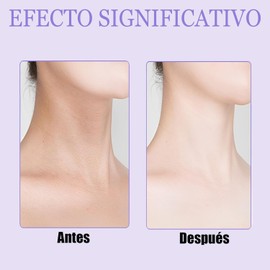 2PCS Crema para Cuello Reafirmante, Reduce Papada Hidratante Fórmula con colágeno que tensa y levanta la piel, atenúa arrugas del cuello y papada, apta para todo tipo de piel.