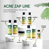 Acne Zap - Shampoo for Scalp Acne – Clear Scalp