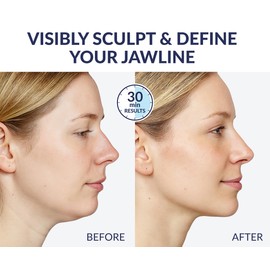 STYLIA V Line Lifting Collagen Mask - Lift, Firm & Contour Jawline - Tightening Double Chin Strap with Hyaluronic Acid & Aloe - Neck Tightening and Lifting Mask - Jawline Shaper Face Lift Tape (2PC)