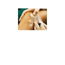 Suprasorb F Wundverb. 10x25 cm Sterile 10 StÃ ¼ ck