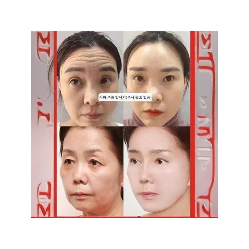 Water Luminous/Wrinkle Free/Salmon/Water-Shine/Functional/Elasticity/Ampoule/Super-Fast/Cell