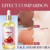 Kit Facial Y Corporal Pastel De Fresa Bioaqua Con 3