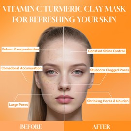 TJE Turmeric Vitamin C Clay Mask for Dark Spots, Dull Skin, Blackheads, Skincare Facial Mask for Cleansing Pores, Moisturizing and Improve Uneven Skin Tone, Face Skincare - Present