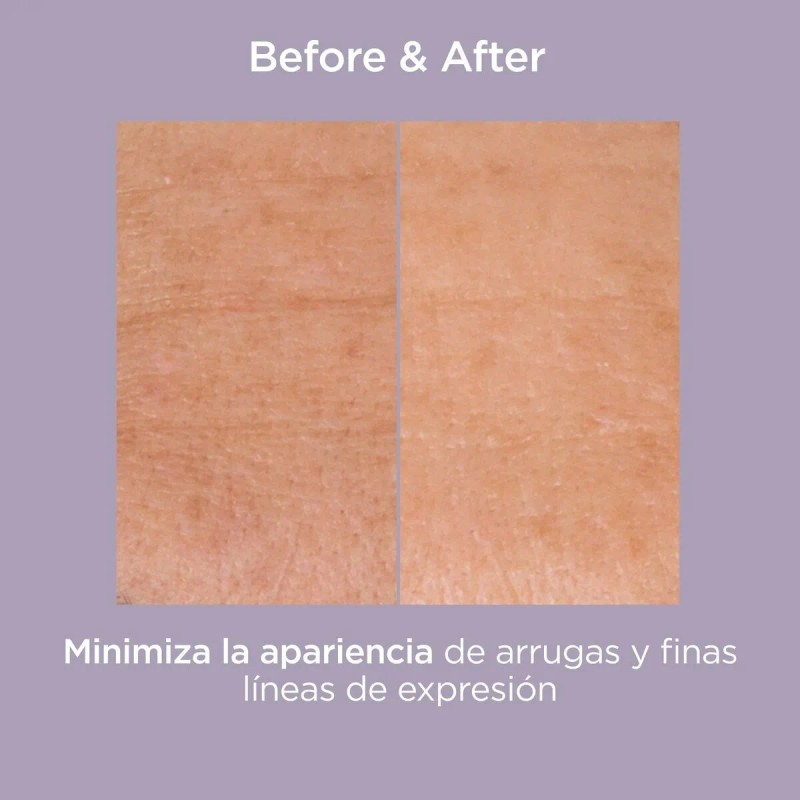 Gel facial Glicoisdin 25 con efecto exfoliante intenso con ácido