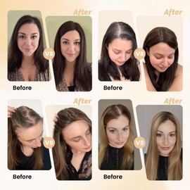 FU SHEN Hair Toppers for Women Real Human Hair Upgrade Swiss Base Human Hair Topper Hair Pieces for Thinning Hair Handmade Premium Remy Toppers Clip in Extensions 10inch