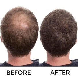 Hair Fibers for Thinning Hair for Women and Men, Hair Color for Gray Hair Coverage Thicker Fuller Hair Loss Instantly Hair Building Fibers Root Touch Up Natural Formula 28g (Medium Brown)