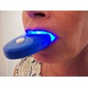 NiceWhites, Professional Teeth Whitening "Mini Blue" Light to Strengthen and