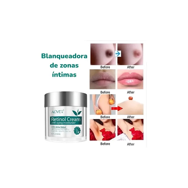 Crema Aclarante Con Retinol Rostro Y Cuerpo Zonas Intimas