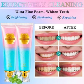 Niacinamide Whitening Toothpaste, Niacinamide Intensive White Toothpastes with Natural Gentle Care Deep Stain Removal, Mint Radiant Whitening Toothpaste, Protects Tooth Enamel, Fresh Breath (1)