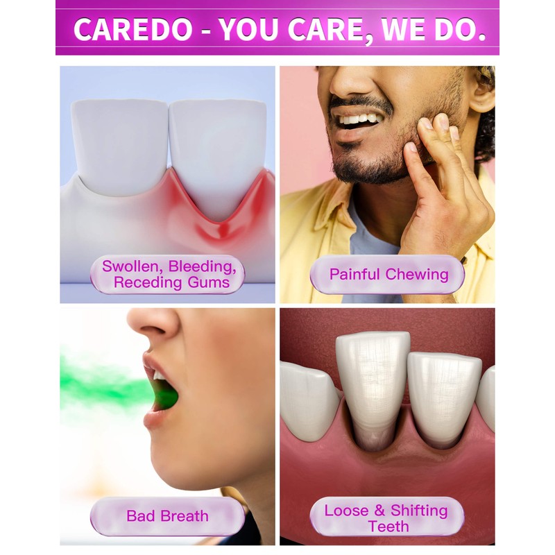 CAREDO Gum Toothpaste for Periodontitis, Gum Repair for Receding Gums,
