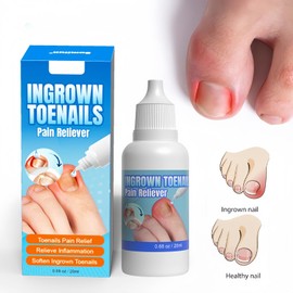 Ingrown Toenail Treatment, Ingrowing Toenail Treatment Extra-Strong, Ingrown Nail Treatments for Toenails, 20ml
