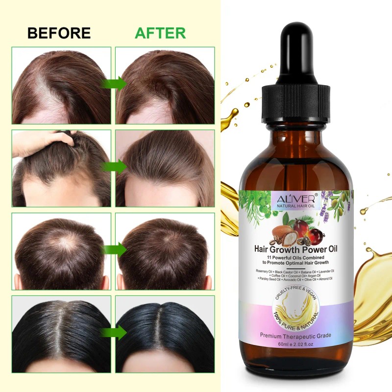 Aceite Aliver Capilar Reparador 60 Ml Hierbas 11 Aceite En