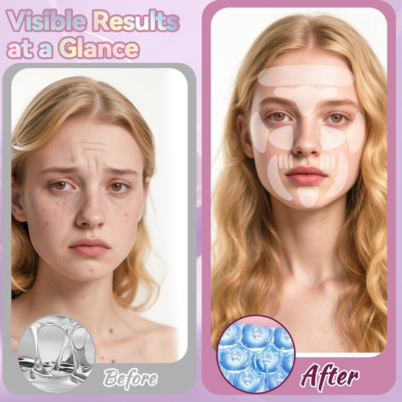 Facial & Forehead Wrinkle Patches, Smile Line Patches 256 Pcs