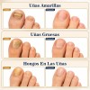 Crema Para El Cuidado De Las Uñas,pomada Reparadora De Uñas