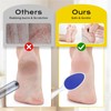 yomanta Foot File, Nano Glass Foot File Callus Remover with