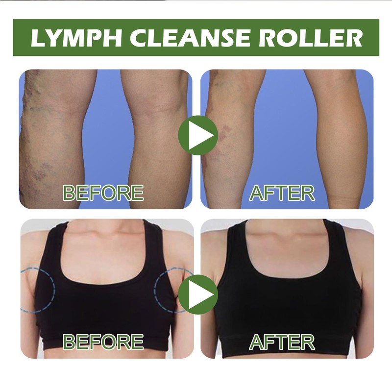 KOAHDE Gesicht Lymphdrainage Roller,Gesichtspflege Lymph Roller,Gesichtsroller zur Lymphdrainage,Lymphdrainage Massage Schönheitsroller,Gesichts-Lymphmassagegerät,Gesicht