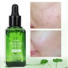 Face Nose Pores Shrinking Repairing Smoothing Blackhead Removal Liquid Essential