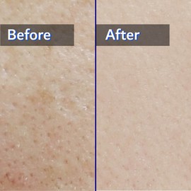 Sunnicorn Hydrating Toner 10.14 Fl Oz - Korean Skin Care, Moisturizing Calming Toner, Vegan + Animal Testing Free, Sensetive Skin, Daily Facial & Ultra Hydrate, Natural Ingredients