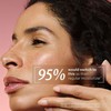 StriVectin SD Advanced PLUS Intensive Humectante ataca la pérdida de