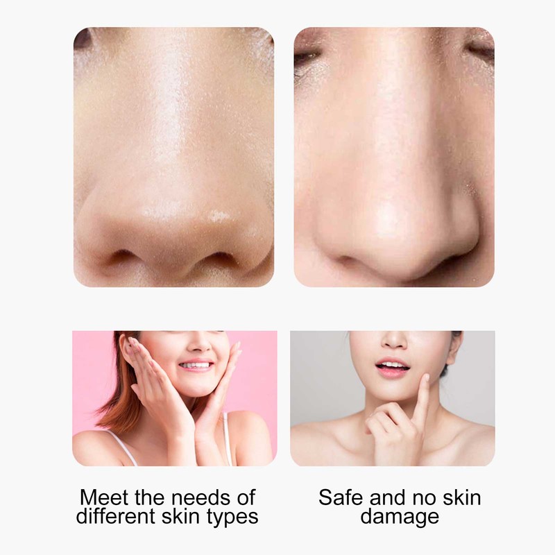 Vacuum Blackhead Removal Electric Pore Cleaner Blackhead Extractor Tool Face