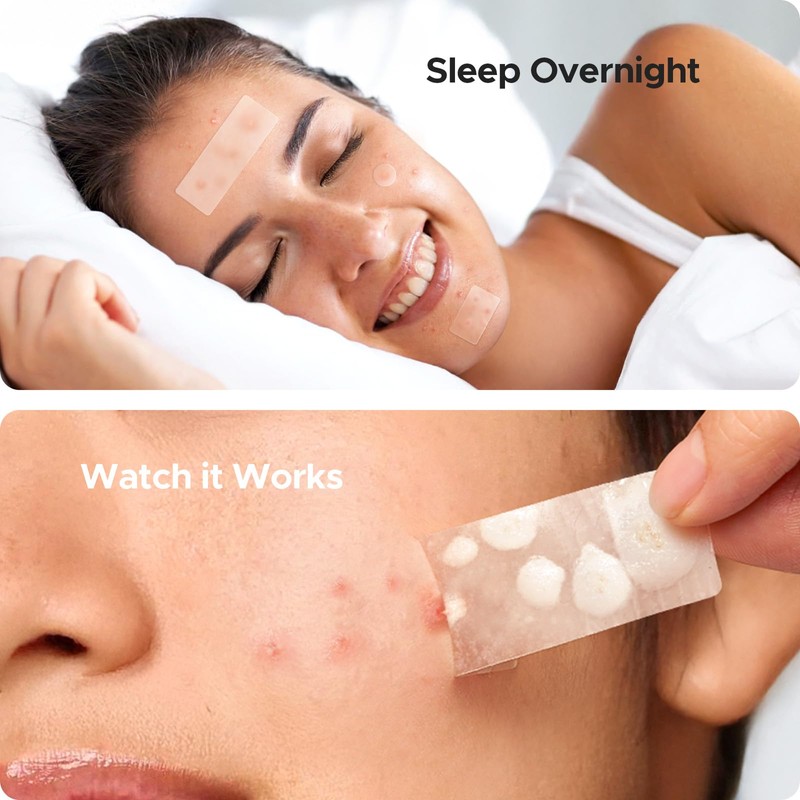 Large Pimple Patches for Face & Body Zit Breakouts, 7