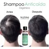 Natiwe Botanica Shampoo Anticaída De Romero, Tepezcohuite, Bergamota 250 Ml