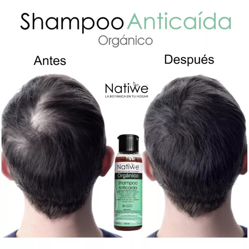 Natiwe Botanica Shampoo Anticaída De Romero, Tepezcohuite, Bergamota 250 Ml