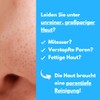 benevi Exfoliating 75 ml for blemished skin opens clogged pores,