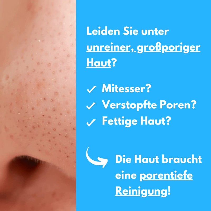 benevi Exfoliating 75 ml for blemished skin opens clogged pores,