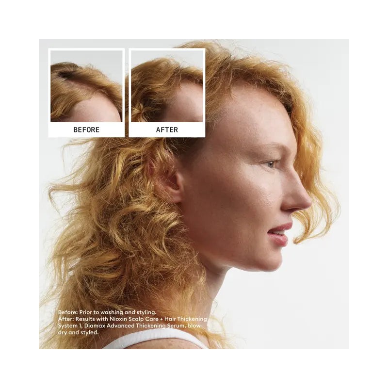 Nioxin Scalp + Hair Thickening System 1 Full Size Kit