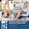 TANGDIAABBCC Varicose Veins Treatment for Legs, Varicose Veins Treatment Cream,