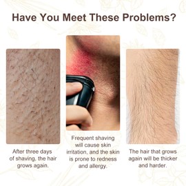 Cyperus Rotundus Oil 100% Natural, Cyprus Rotundus Oil for Hair Removal, Reducing Body Hair Growth & Smoothing Skin | Suitable for All Skin Types, 60ml with Dropper (2 Packs)