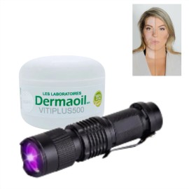 Crema De Melagenina Y Piperina Para Vitíligo + Lampara Uv