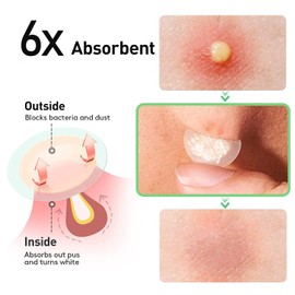 Pack of 600 Pimple Patches Hydrocolloid Pimple Plasters Invisible Anti Pimple Patches Acne Patch Day & Night 2-in-1 Waterproof Pimple Patch Acne Patch (600A)