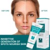 Crema Correctora Facial Manchas Acné Paño Puntos Negros