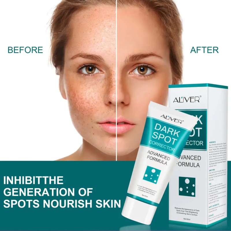 Crema Correctora Facial Manchas Acné Paño Puntos Negros