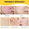 XdealCozyxc 60 PCS Kojic Acid and Turmeric Pads, Gentle Cotton