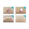MUTOFACE Dermatology Large Capacity Remover Nose Sebum/Blackhead Milk Mile Cleansing