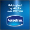 Vaseline Expert Care Dark Spot Rescue Hand and Body Lotion