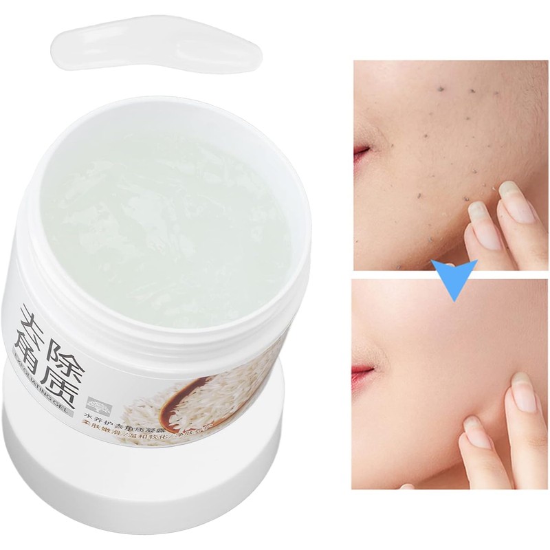 Gel Exfoliante de Arroz para Limpieza Profunda y Hidratación, 4.9,