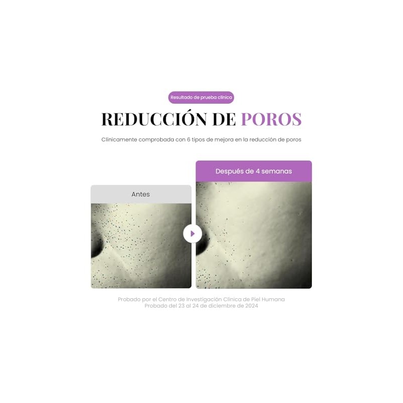 EQQUALBERRY Suero Facial Purple PDRN Minimiza Poros 30 ml
