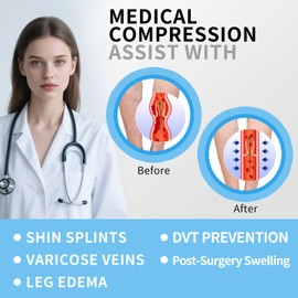 HBM 30-40 mmHg Compression Socks for Women & Men Open Toe Support Stocking for Varicose Veins Swelling Travel (Beige L )