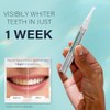 CAREFOR- Fórmula avanzada de blanqueamiento para dientes sensibles: nuestras tiras