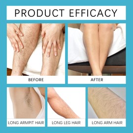 9Pcs Ingrown Hair Treatment Patch & Serum Set for Underarms, Legs, Arms, Beard - Hydrating Pore Unclogging Stickers with Gentle Smoothing Solution, Daily Home & Salon Use