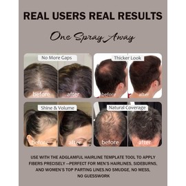 Hair Building Fibers- Instant Hair Thickening Powder for Men & Women, Hair Building Fibers for Thinning Hair, Root Touch Up Hair Color, Waterproof, Sweatproof, Natural Look,30g Dark Brown