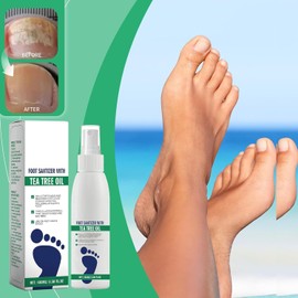 2PCS Foot Sanitizer Spray with Tea Tree Oil,Clear Foot Sanitizer Spray,Tea Tree Oil, 100 ml/3.5 oz