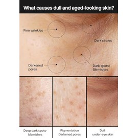 CELIMAX Crema para Manchas y Poros Pore  Dark Spot Brightening Cream con Niacinamida 5 y cido Tranexmico 5 - Ceramide NP - Tono uniforme y luminoso - 